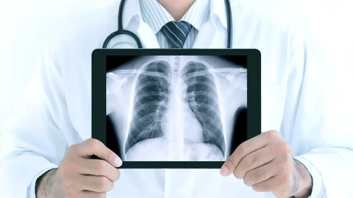 Siemens HF X-ray machine